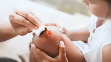 انشا در مورد زخم با مقدمه بدنه نتیجه